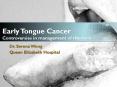 Early Tongue Cancer Controversies in management of the neck PowerPoint PPT Presentation