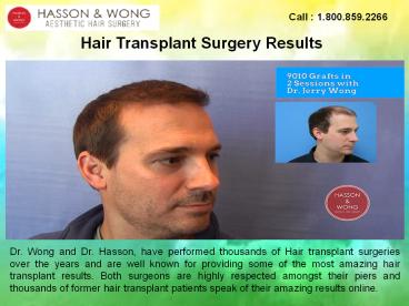 Hair Transplantation Clinic in British Columbia