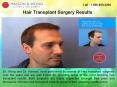 Hair Transplantation Clinic in British Columbia PowerPoint PPT Presentation