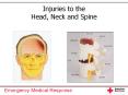 Injuries to the Head, Neck and Spine PowerPoint PPT Presentation