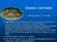 Sepsis neonatal  conferentiar L.Cioc PowerPoint PPT Presentation