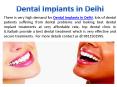 Get Great Implant Treatments from Dental implants in kalkaji