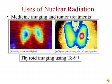 Medicine imaging and tumor treatments