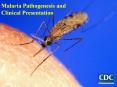 Malaria%20Pathogenesis%20and%20Clinical%20Presentation PowerPoint PPT Presentation