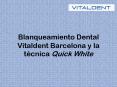 Blanqueamiento dental Vital Dent barcelona: técnica Quick White PowerPoint PPT Presentation