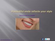 Get Better Looking Teeth with Porcelain Veneers