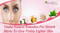 Useful Natural Remedies For Stretch Marks To Give Visibly Lighter Skin PowerPoint PPT Presentation