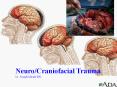 Neuro/Craniofacial Trauma Lt. Joseph Meade RN PowerPoint PPT Presentation