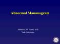 Abnormal Mammogram PowerPoint PPT Presentation