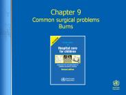 Chapter 9 Common surgical problems Burns