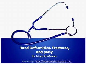 Hand Deformities, Fractures, and palsy