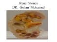 Renal Stones DR. Gehan Mohamed PowerPoint PPT Presentation