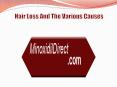 Hair Loss And The Various Causes PowerPoint PPT Presentation