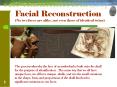 Facial Reconstruction PowerPoint PPT Presentation