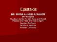 Epistaxis PowerPoint PPT Presentation
