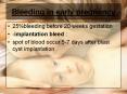 Bleeding in early pregnancy PowerPoint PPT Presentation