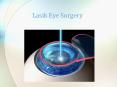 Lasik Eye Surgery in Bangalore PowerPoint PPT Presentation