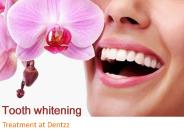 Tooth whitening treatment at dentzz