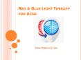 Red & Blue Light Therapy for Acne PowerPoint PPT Presentation