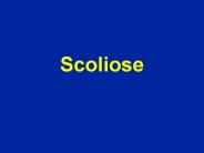 Scoliose