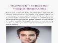 Beard Hair Transplant Saudi Arabia PowerPoint PPT Presentation