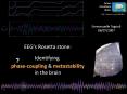 EEG PowerPoint PPT Presentation