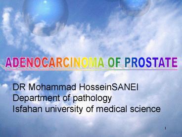 ADENOCARCINOMA OF THE PROSTATE