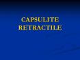 CAPSULITE RETRACTILE PowerPoint PPT Presentation