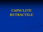 CAPSULITE RETRACTILE