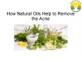 How Natural Oils Help to Remove the Acne PowerPoint PPT Presentation