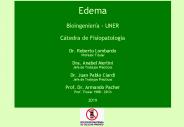 Edema  Bioingenier