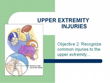 UPPER EXTREMITY INJURIES