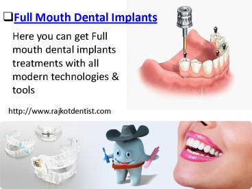 Rajkot Smile Makeover Clinic in Gujarat Offer Full Mouth Rehabilitation in India