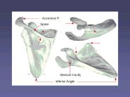 Acromion%20P.