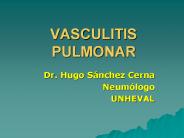 VASCULITIS PULMONAR