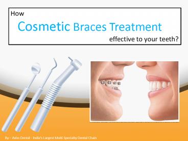 How is Cosmetic Braces treatment effective to your teeth?