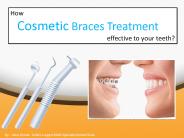 How is Cosmetic Braces treatment effective to your teeth?
