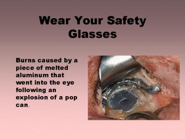 Wear Your Safety Glasses