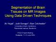 Segmentation of Brain Tissues on MR Images Using Data Driven Techniques PowerPoint PPT Presentation