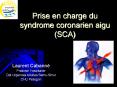 Prise en charge du syndrome coronarien aigu (SCA) PowerPoint PPT Presentation