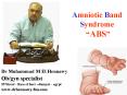 Amniotic Band Syndrome  PowerPoint PPT Presentation