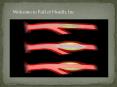 Atherosclerosis Treatment at Full of Health, Inc (1) PowerPoint PPT Presentation