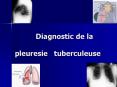 Diagnostic de la pleuresie  tuberculeuse PowerPoint PPT Presentation