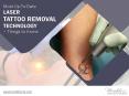 Laser Tattoo Removal in Kansas City - Things to Know! PowerPoint PPT Presentation