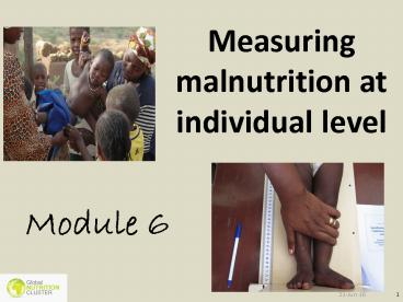 Measuring malnutrition at individual level