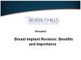 Breast Implant Revision_ Benefits and Importance PowerPoint PPT Presentation