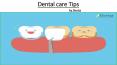 Dental care Tips by Dentzz PowerPoint PPT Presentation