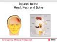 Injuries to the Head, Neck and Spine PowerPoint PPT Presentation
