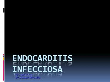 ENDOCARDITIS INFECCIOSA