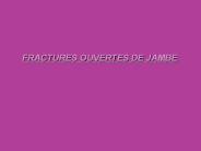 STRATEGIE THERAPEUTIQUE DEVANT UNE FRACTURE OUVERTE